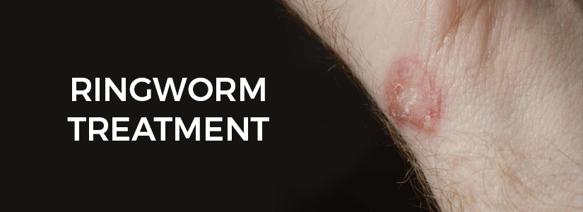 Skin Specialist in Chennai